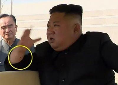 جای سوزن روی مچ رهبر کره شمالی ، چه بلایی سر کیم جونگ اون آمده است؟
