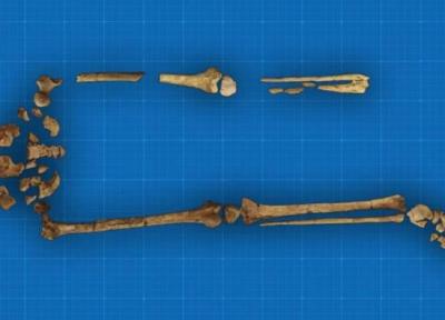 عکس ، 31 هزار سال عمر اولین قطع عضو پزشکی تاریخ!