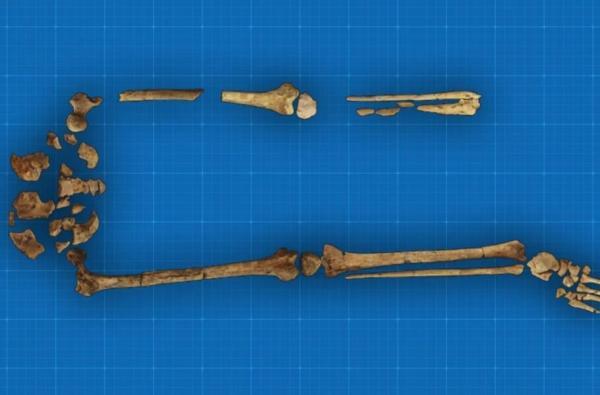 عکس ، 31 هزار سال عمر اولین قطع عضو پزشکی تاریخ!